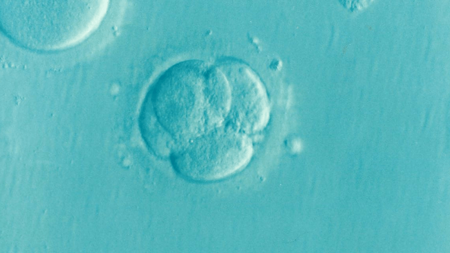 体外受精はなぜ妊娠率が高いのか？